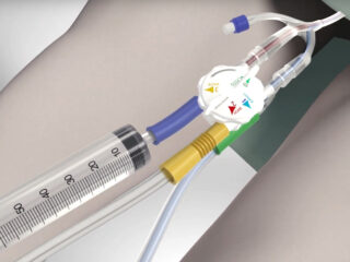 hmc-lavaggi-vescicali